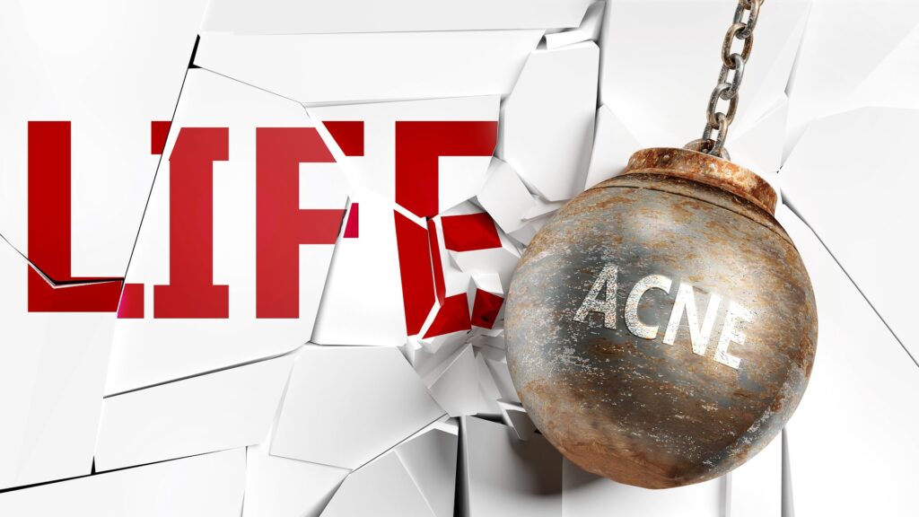Picture of a ball and chain that says acne hitting a wall that says life. 