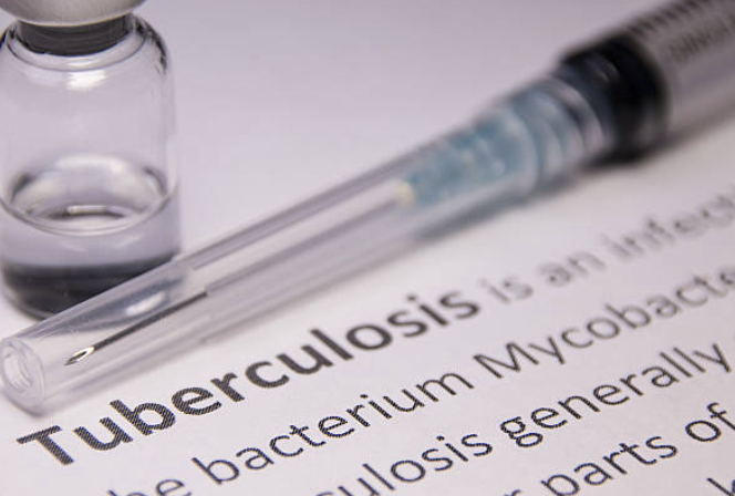 A close-up of the definition of tuberculosis.